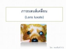 Lens luxation-page-001 title